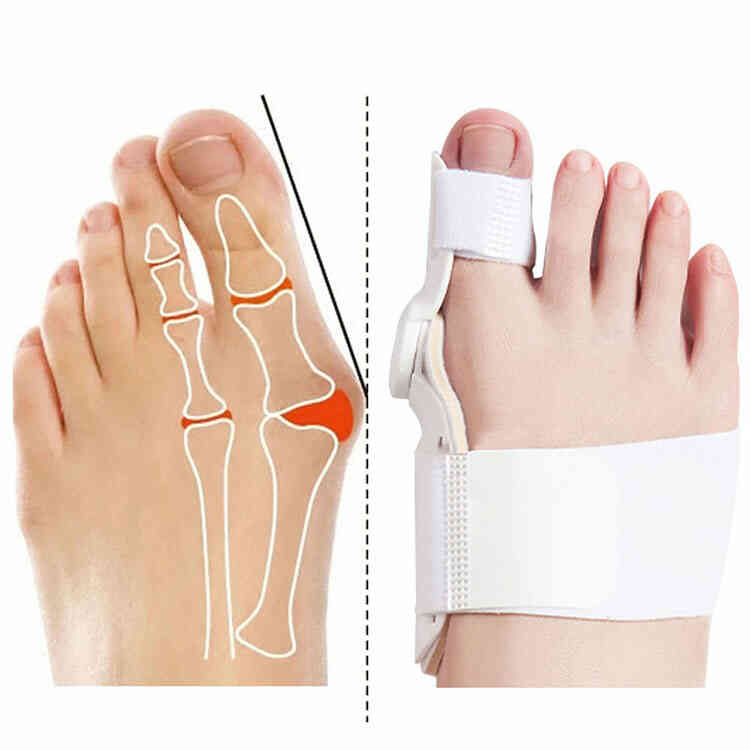 Corrector Ortopédico de Juanetes Ajustable | Férula Hallux Valgus