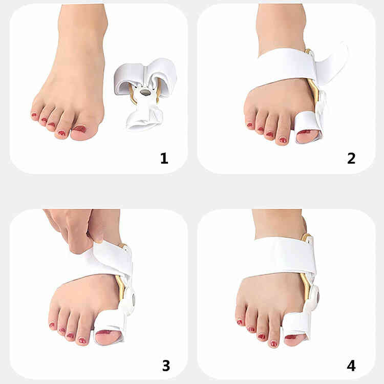 Corrector Ortopédico de Juanetes Ajustable | Férula Hallux Valgus
